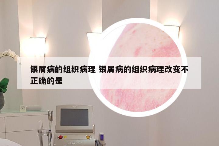 银屑病的组织病理 银屑病的组织病理改变不正确的是