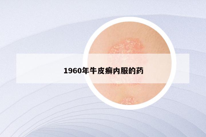 1960年牛皮癣内服的药