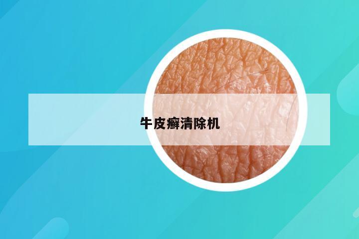 牛皮癣清除机