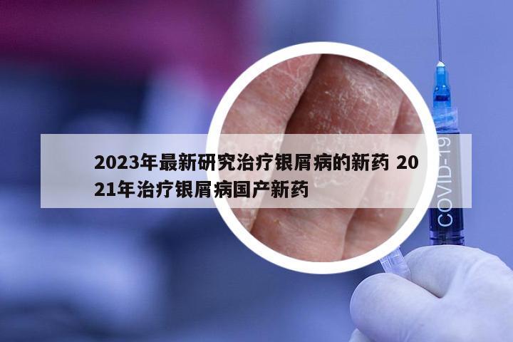 2023年最新研究治疗银屑病的新药 2021年治疗银屑病国产新药