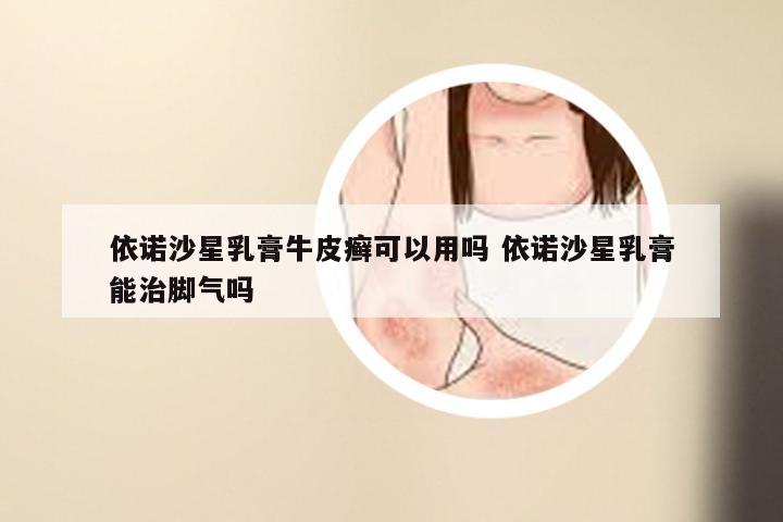 依诺沙星乳膏牛皮癣可以用吗 依诺沙星乳膏能治脚气吗