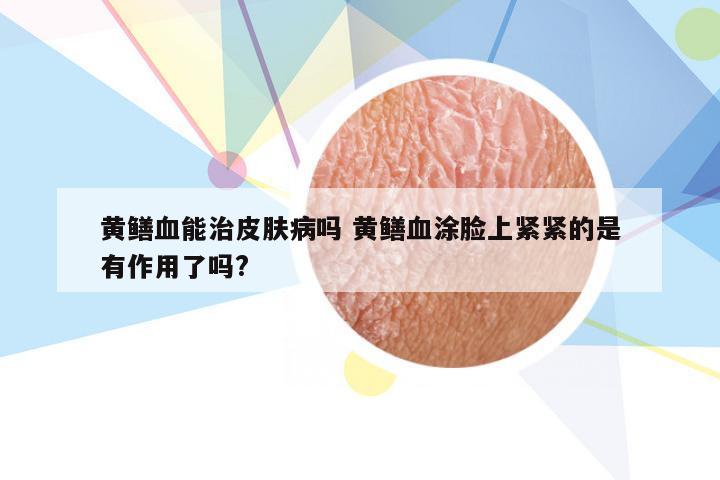 黄鳝血能治皮肤病吗 黄鳝血涂脸上紧紧的是有作用了吗?