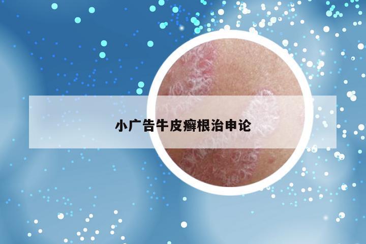 小广告牛皮癣根治申论