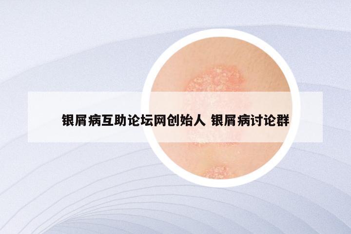 银屑病互助论坛网创始人 银屑病讨论群