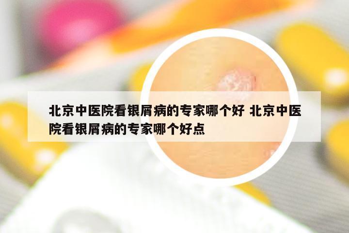 北京中医院看银屑病的专家哪个好 北京中医院看银屑病的专家哪个好点