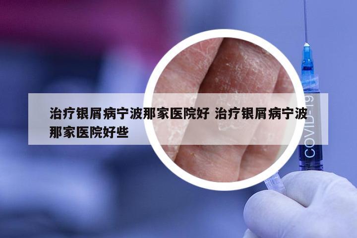 治疗银屑病宁波那家医院好 治疗银屑病宁波那家医院好些