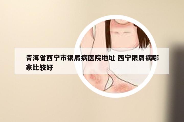 青海省西宁市银屑病医院地址 西宁银屑病哪家比较好
