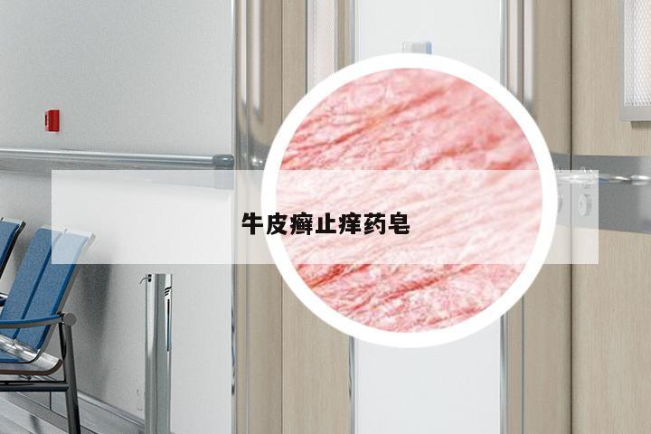 牛皮癣止痒药皂