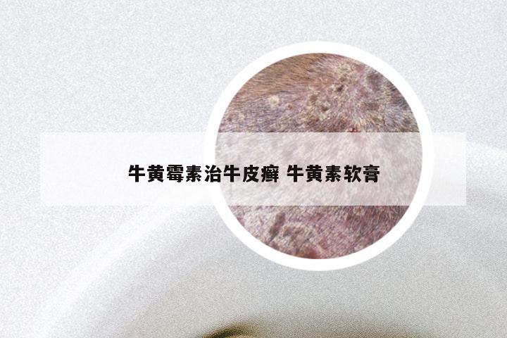 牛黄霉素治牛皮癣 牛黄素软膏