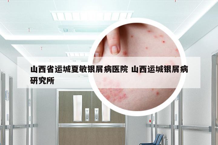 山西省运城夏敏银屑病医院 山西运城银屑病研究所