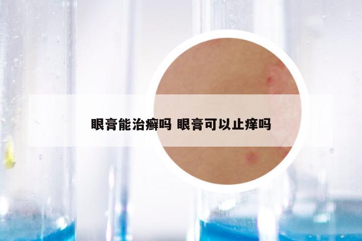 眼膏能治癣吗 眼膏可以止痒吗