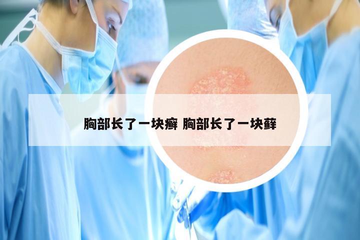 胸部长了一块癣 胸部长了一块藓