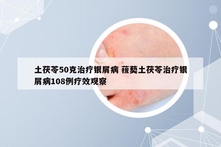 土茯苓50克治疗银屑病 菝葜土茯苓治疗银屑病108例疗效观察