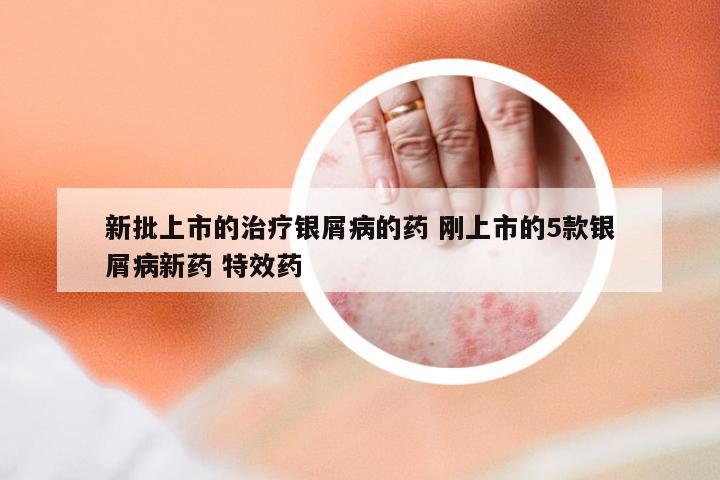 新批上市的治疗银屑病的药 刚上市的5款银屑病新药 特效药