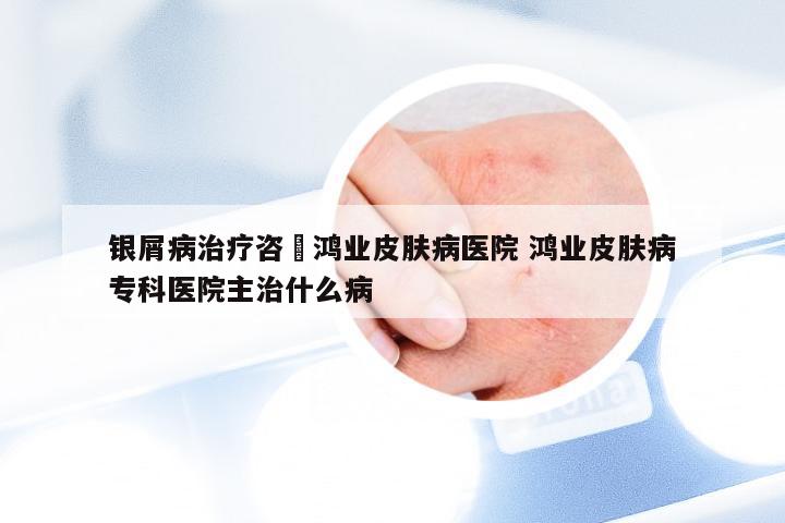 银屑病治疗咨詢鸿业皮肤病医院 鸿业皮肤病专科医院主治什么病