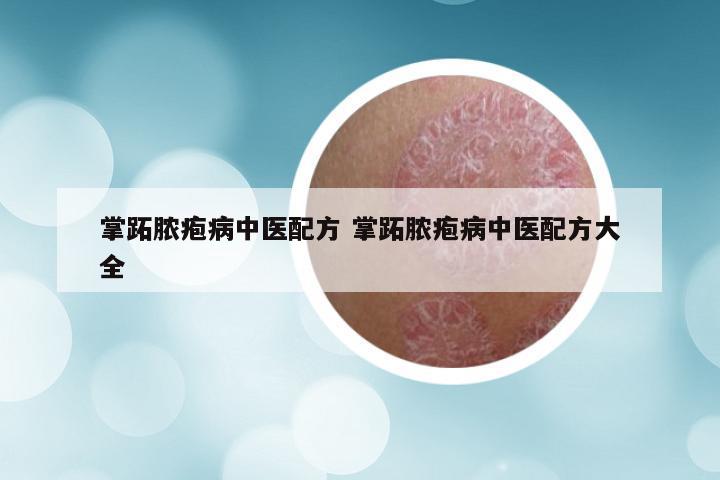 掌跖脓疱病中医配方 掌跖脓疱病中医配方大全