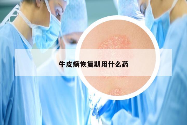 牛皮癣恢复期用什么药