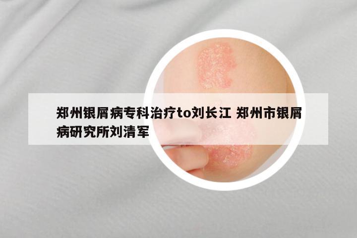 郑州银屑病专科治疗to刘长江 郑州市银屑病研究所刘清军