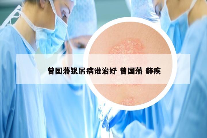 曾国藩银屑病谁治好 曾国藩 藓疾
