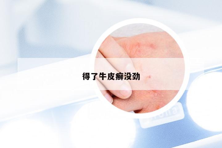 得了牛皮癣没劲