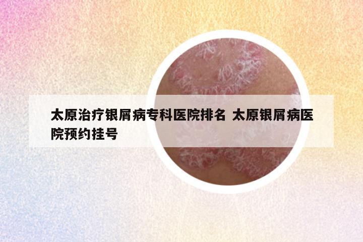 太原治疗银屑病专科医院排名 太原银屑病医院预约挂号