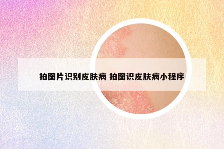 拍图片识别皮肤病 拍图识皮肤病小程序
