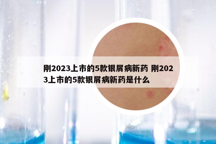 刚2023上市的5款银屑病新药 刚2023上市的5款银屑病新药是什么