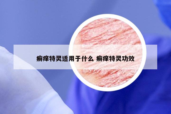 癣痒特灵适用于什么 癣痒特灵功效