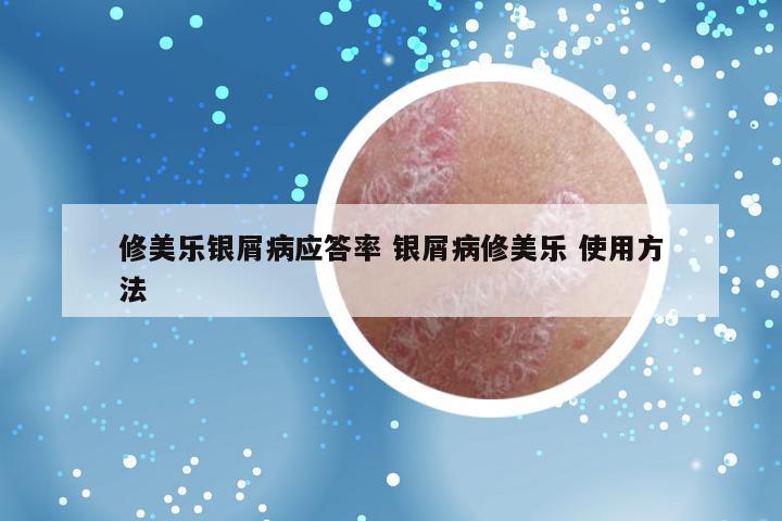修美乐银屑病应答率 银屑病修美乐 使用方法