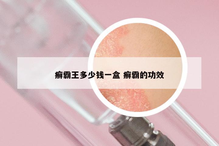 癣霸王多少钱一盒 癣霸的功效