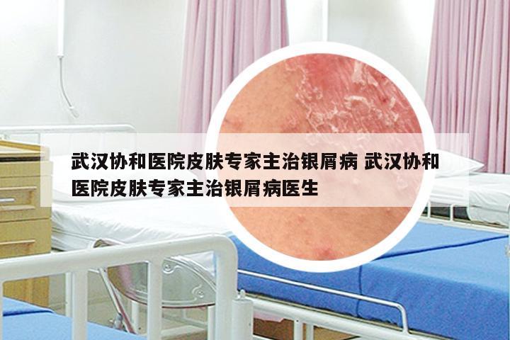 武汉协和医院皮肤专家主治银屑病 武汉协和医院皮肤专家主治银屑病医生