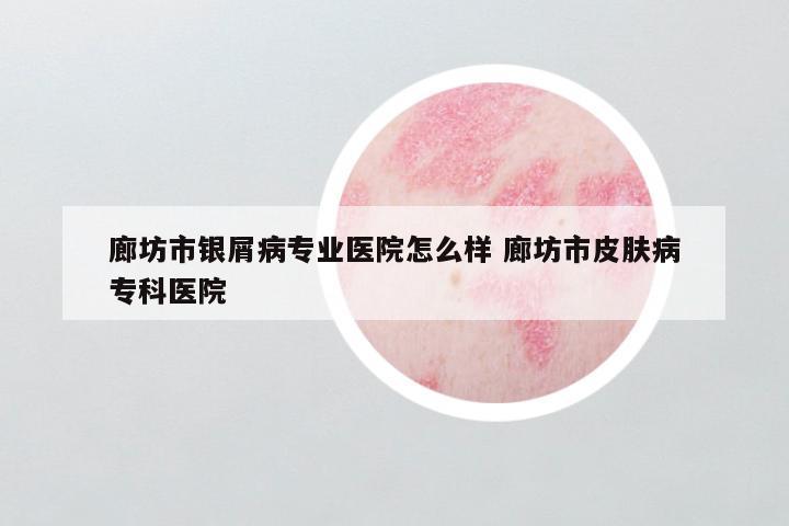 廊坊市银屑病专业医院怎么样 廊坊市皮肤病专科医院