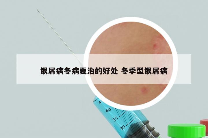 银屑病冬病夏治的好处 冬季型银屑病