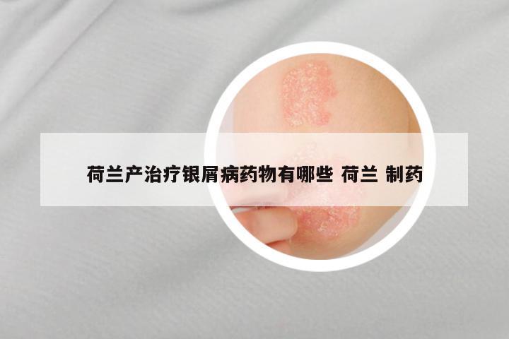荷兰产治疗银屑病药物有哪些 荷兰 制药
