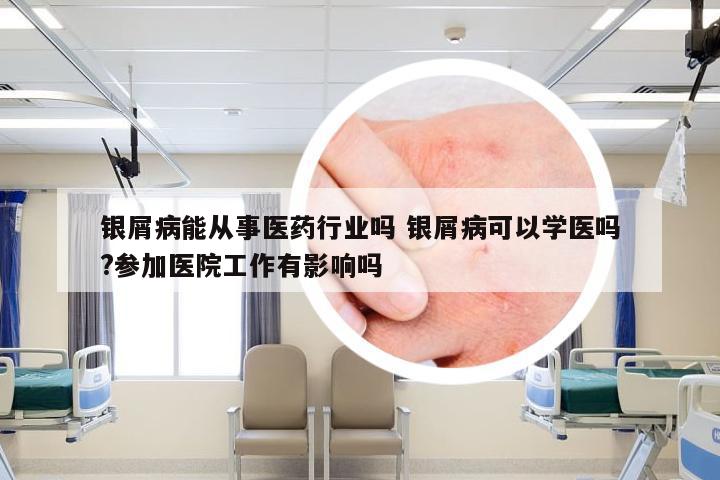 银屑病能从事医药行业吗 银屑病可以学医吗?参加医院工作有影响吗