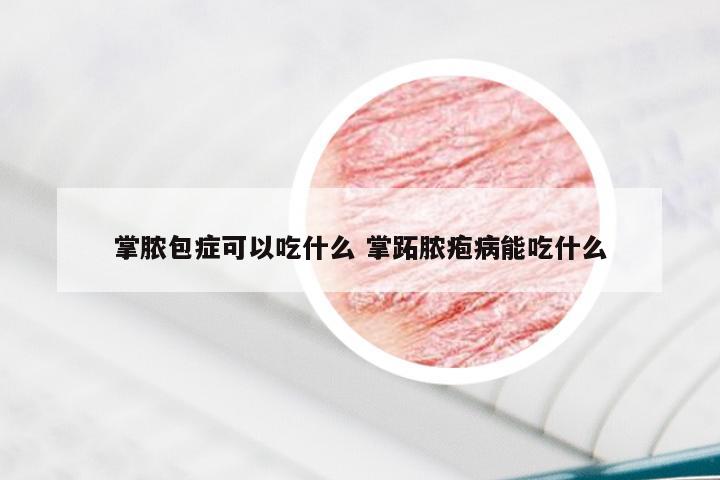 掌脓包症可以吃什么 掌跖脓疱病能吃什么