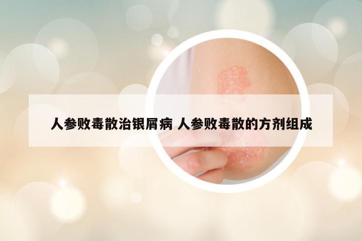 人参败毒散治银屑病 人参败毒散的方剂组成