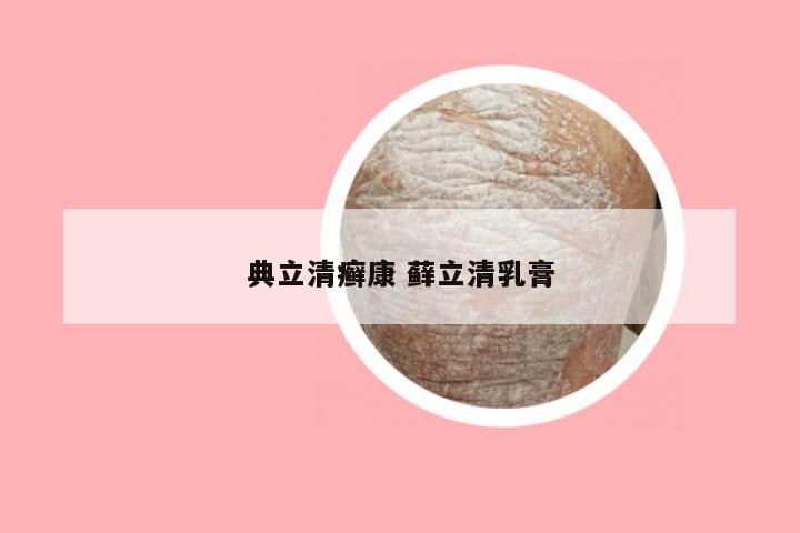 典立清癣康 藓立清乳膏