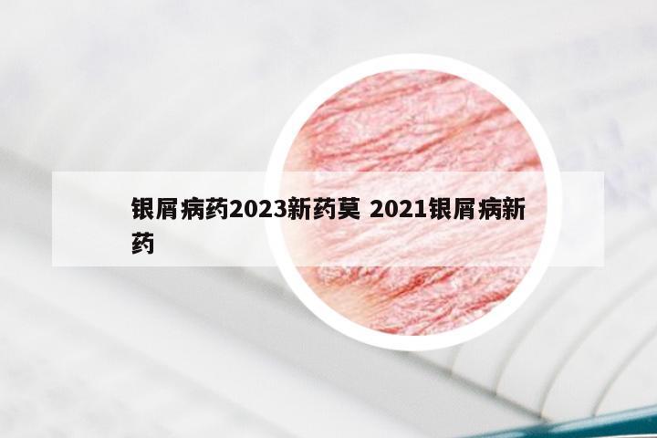 银屑病药2023新药莫 2021银屑病新药