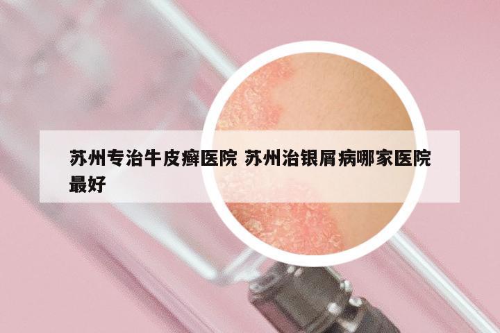 苏州专治牛皮癣医院 苏州治银屑病哪家医院最好