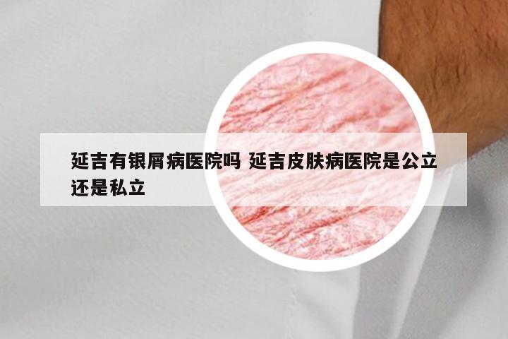 延吉有银屑病医院吗 延吉皮肤病医院是公立还是私立