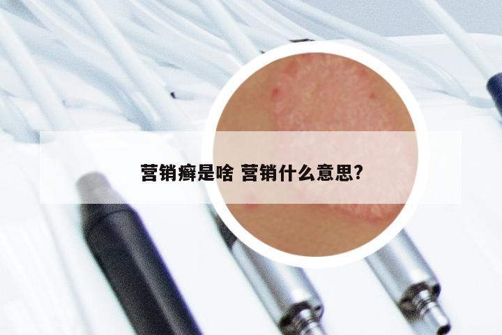 营销癣是啥 营销什么意思?