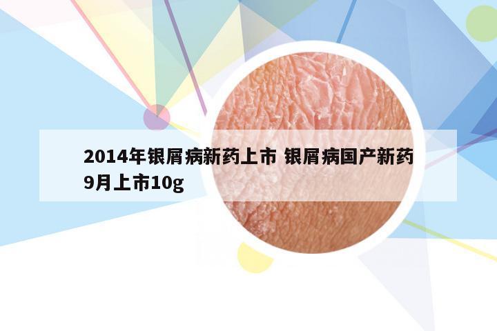 2014年银屑病新药上市 银屑病国产新药9月上市10g