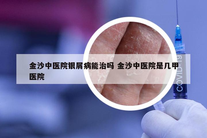 金沙中医院银屑病能治吗 金沙中医院是几甲医院