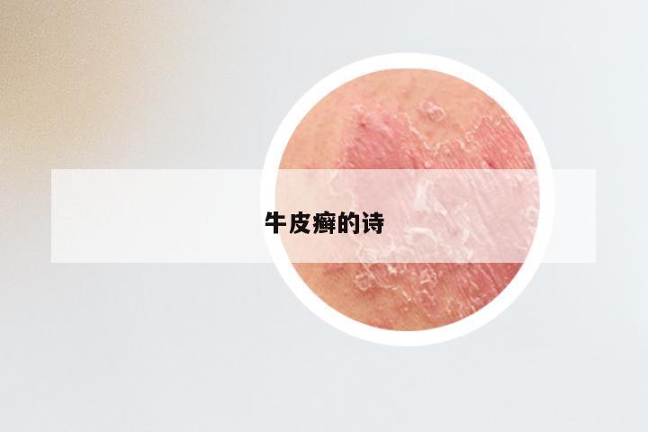 牛皮癣的诗