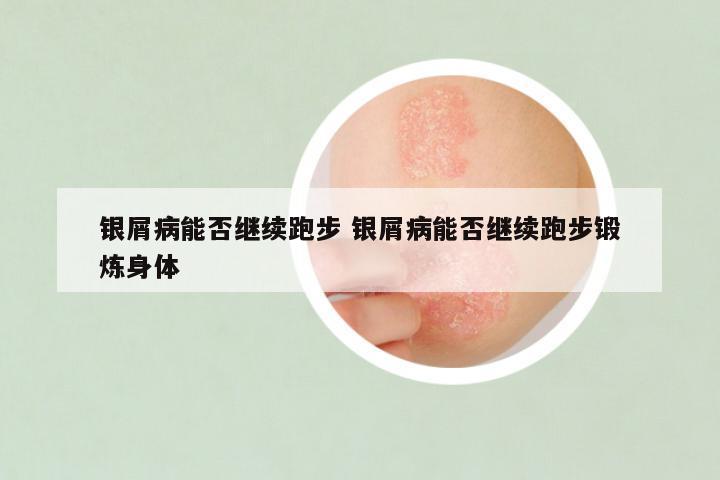 银屑病能否继续跑步 银屑病能否继续跑步锻炼身体