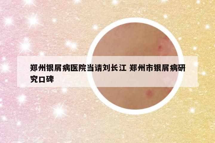 郑州银屑病医院当请刘长江 郑州市银屑病研究口碑
