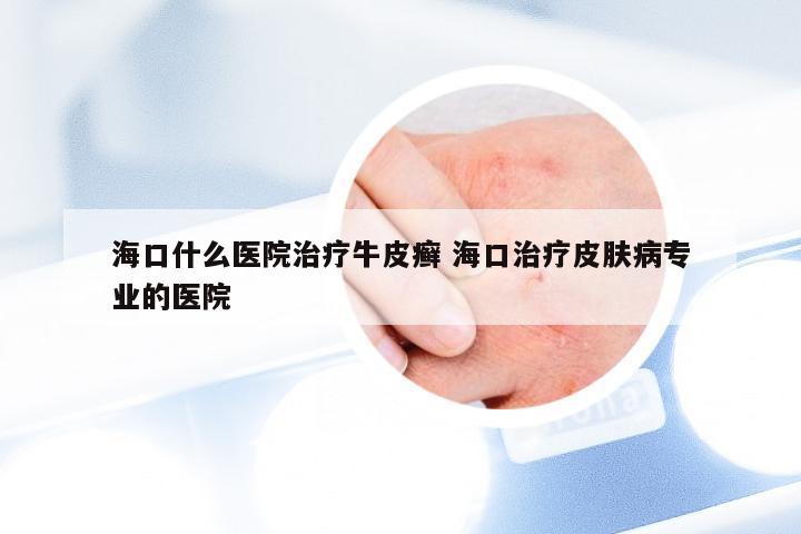 海口什么医院治疗牛皮癣 海口治疗皮肤病专业的医院