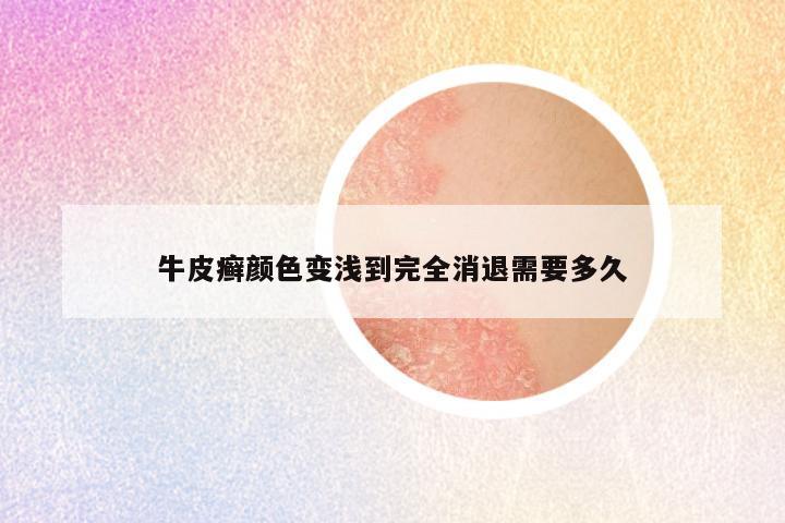 牛皮癣颜色变浅到完全消退需要多久