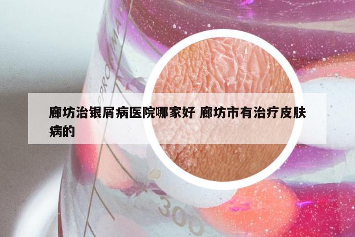 廊坊治银屑病医院哪家好 廊坊市有治疗皮肤病的